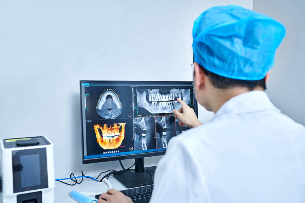 Best Emergency Wisdom Teeth Removal in Toledo, IA